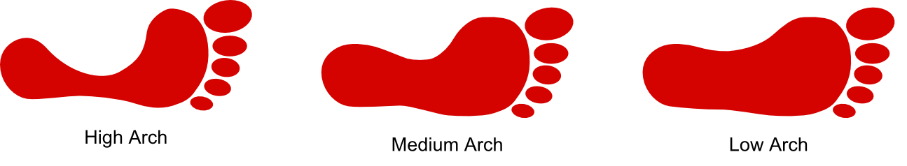 foot-arch