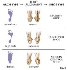 High arches hotsell and shin splints