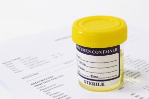 Urine sample in container with report