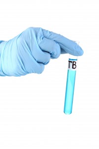 Test tube labeled Tuberculosis(TB) isolated on white